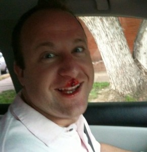 Jared Polis Bloody Nose