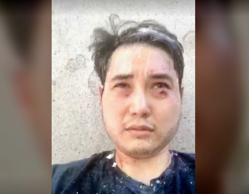 Attacked by antifa as he covered their riots: Andy Ngo to speak in Colorado